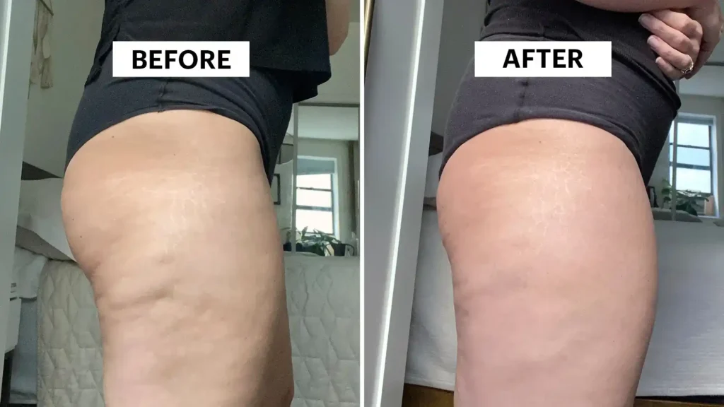 Sculpting Your Bum: Can Toning Exercises Really Reduce Cellulite? 1 Do Toning Exercise Ruislip Really Tackle Cellulite?